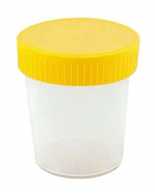 Urinbecher mit Schraubdeckel 100 ml, 90 St.