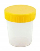 Urinbecher mit Schraubdeckel 100 ml, 90 St.