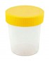 Urinbecher mit Schraubdeckel 100 ml, 90 St.